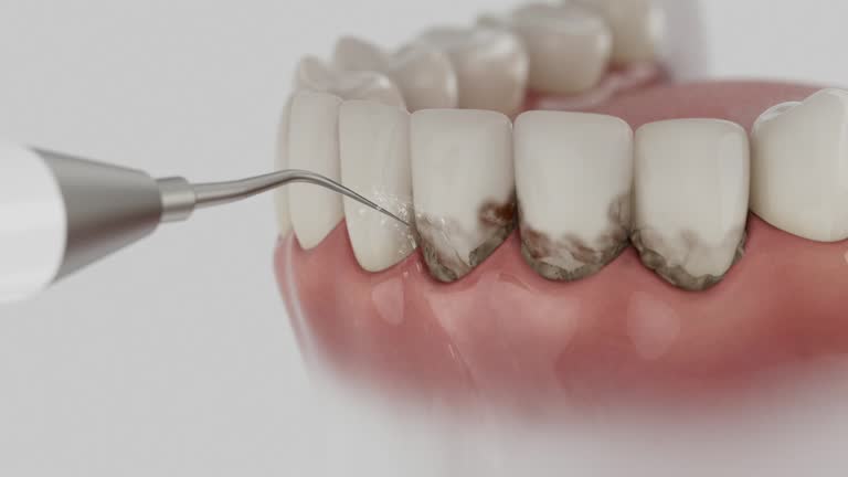 Reliable Dental Implants contractor in Corte Madera, CA by Smile Center Dentistry